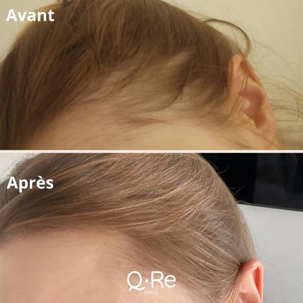 POUR LES CHEVEUX ET LES ONGLES - visuel 3